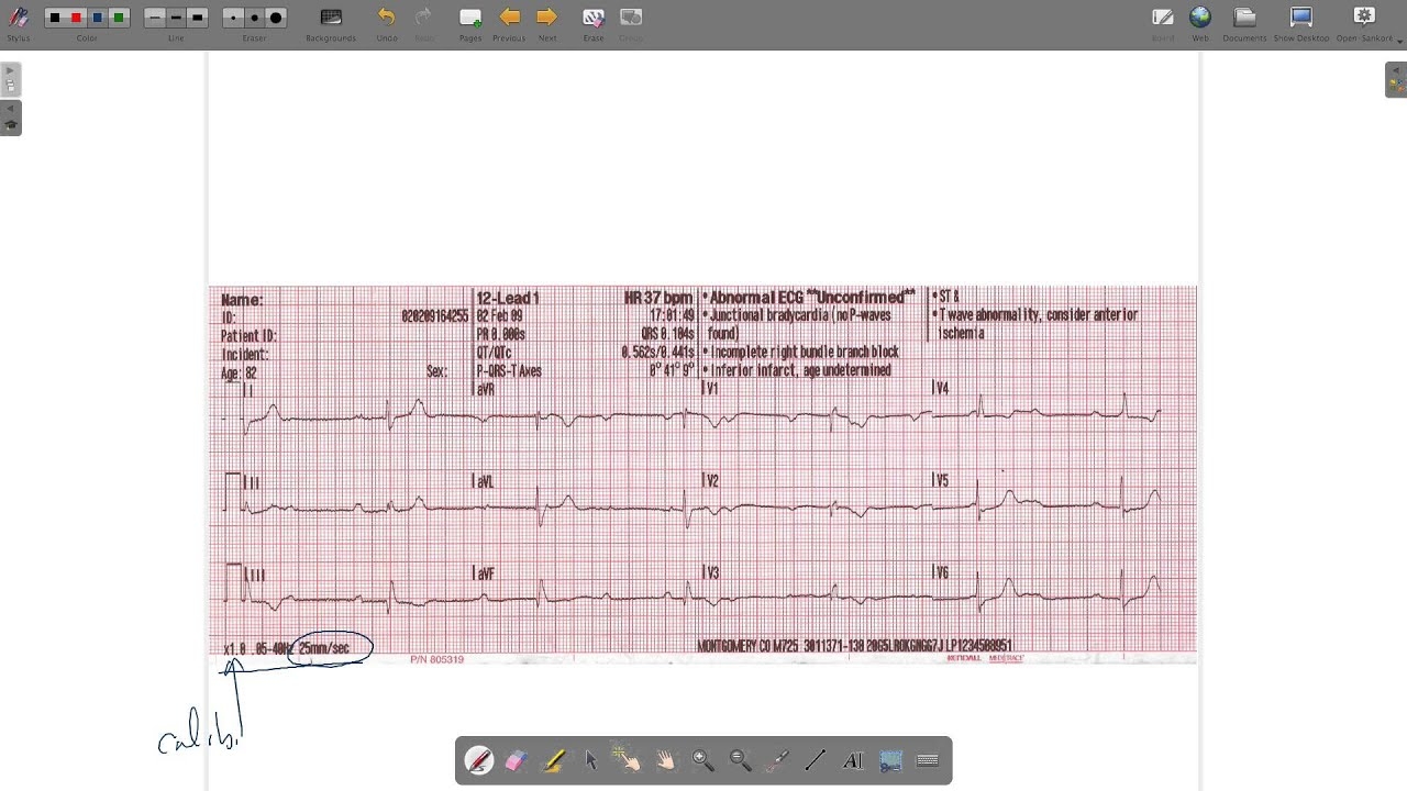 ECG Paper