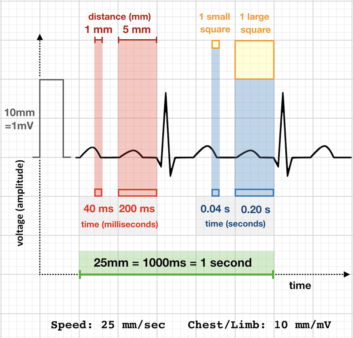 ECG Rate Interpretation LITFL Medical Blog ECG Library Basics